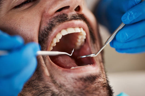Best Tooth Pain Emergency Relief  in Tice, FL